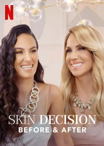 Skin Decision: Before and After - Saison 1 - vf-hq